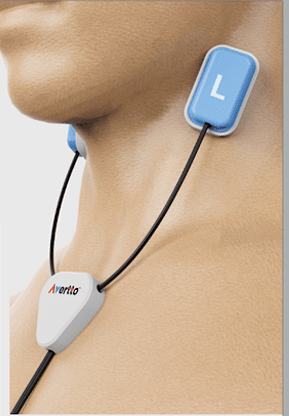 Sensor vestível da startup Avertto colocado no pescoço de um paciente para monitorar as artérias carótidas e prevenir AVC.