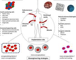 Ilustração de implante bioartificial para diabetes mostrando a tecnologia de encapsulamento de células.