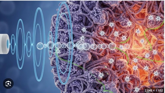 lustração de nanobolhas rompendo a barreira de um tumor sólido sob efeito de ultrassom.