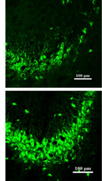 Comparação de microscopia fluorescente mostrando no painel superior a perda de neurônios (pontos verdes) após crises epilépticas e, no painel inferior, a preservação dessas células após o tratamento com o peptídeo TXM-CB3.