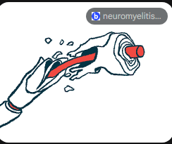 Ilustração científica de um neurónio com destaque para a bainha de mielina e o processo de reparação nervosa.