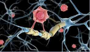Ilustração científica mostrando células T do sistema imunológico (células assassinas) interagindo com o vírus Epstein-Barr no sistema nervoso central.